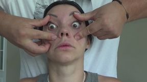 bulging eyes
