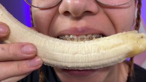 Vore braces fetish