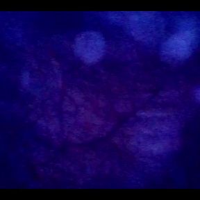 Beautiful Inside POV of My Full Bladder with the Endoscope!