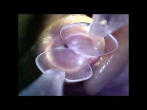 endoscope in 2 spoons push inside urethra cock exploration