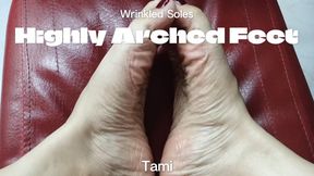 High arches and wrinkled soles on small feet (4)