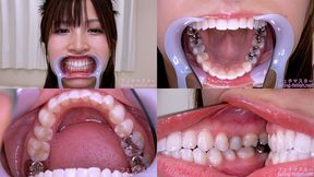 Sayaka Nanjo - Watching Inside mouth of Japanese cute girl - MOV 1080p