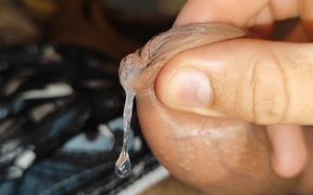 Cumshot of the Largest Phimosis Foreskin in the World.
