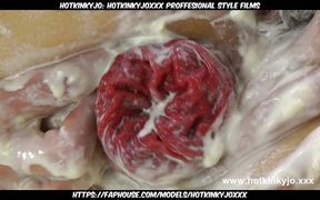 Fist Fuck Banana Split & Prolapse by Hotkinkyjo