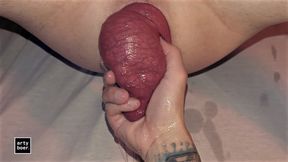 arty boer and prolapsiboy.