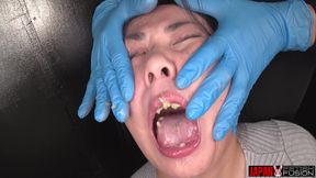 Honoka Sakamoto Trapped: Tongue Clamps, Stretched Face, and No Way Out