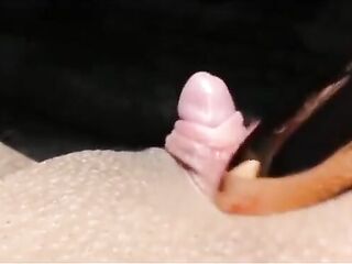 This clitoris has a foreskin