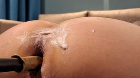 Anal Plug