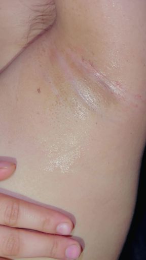 My milky armpit