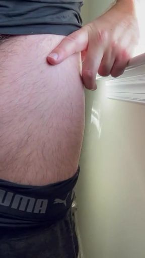 Must-see moment from &quot;Patient with reoccurring moderate erections issues&quot;