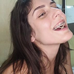 Cum on butterfly braces