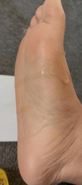 Oily Feet