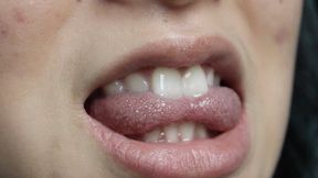 Aurora's Teeth Seduce You Again