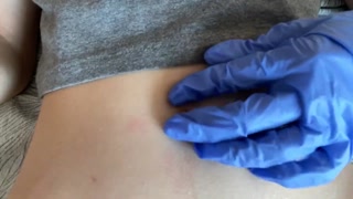 Belly button and medical gloves