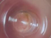 A deep look inside my ass - inside anal view - Straightdoesbi