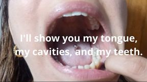 I'll show you my tongue, my cavities, and my teeth.