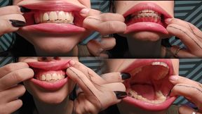 My big mouth in the close up