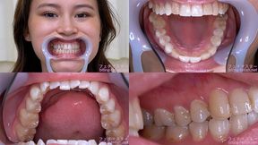 Erika Kononoba - Watching Inside mouth of Japanese cute girl - MOV
