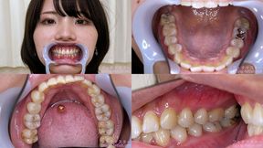 Haruna Kawai - Watching Inside mouth of Japanese cute girl - 1080p