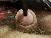 Painful sound removal ends with golden surprise