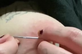 Nipple Needles Rip Through Massive Tits Agony Gush