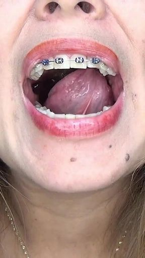 I Swallowed Some Very Long Gummy Worms!!