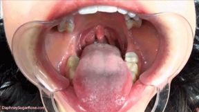 * 854x480p * Cheek Retractor Tongue Tease -Mov