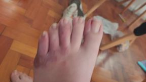 Morning Foot Check – Inspecting My Dry Flaky Feet, Scars and Rough Skin Close-Up with Natural Imperfections