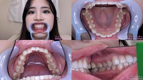 Rei - Watching Inside mouth of Japanese cute girl bite-221-1 - wmv