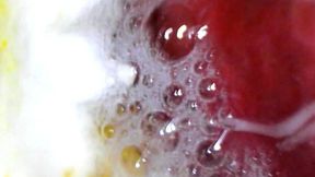 Full screen PillCam digestion of gummies 1080HD