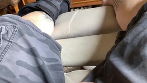 broken leg fetish