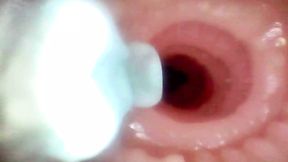 Endoscope reveals wife's tight pussy and ass