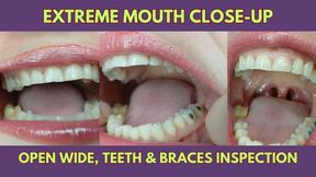 Extreme Mouth Close-Up – Open Wide, Teeth & Braces Inspection