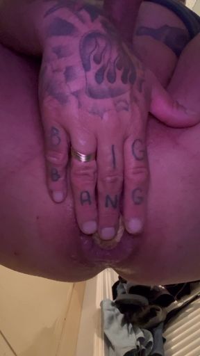 My Anal Vagina