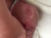 close up head massage "frenulum froid"
