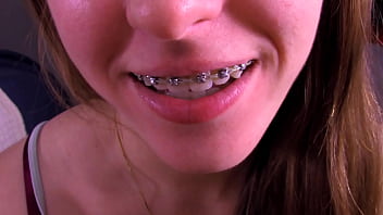 Blow It On My Braces