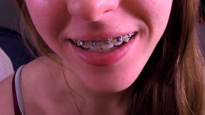 Blow It On My Braces