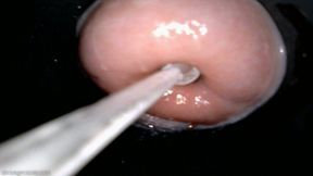 cervix sounding endoscopy quickie (720 wmv)