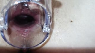 Soak SOAK Snatch orgasm into with speculum showing the cervix