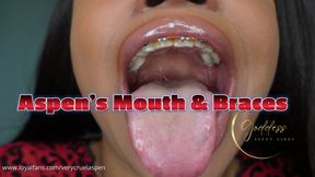 Aspen's Mouth & Braces