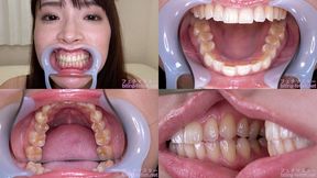 Hinata Tachibana - Watching Inside mouth of Japanese cute girl - 1080p