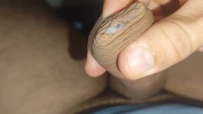 I Have the Largest Ejaculating Phimosis in the World!!