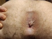 Hole Spreading & Fart Compilation 1 (hemorrhoids)