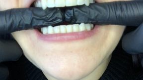 Mouth check Mouth check Mouth check
