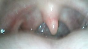 Baileys Endoscopic Journey