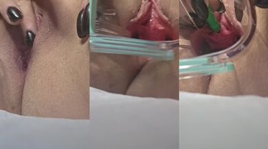 Spread wide open pissing through a catheter. Look at what a mess i made.