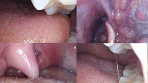 Macro endoscope mouth tour