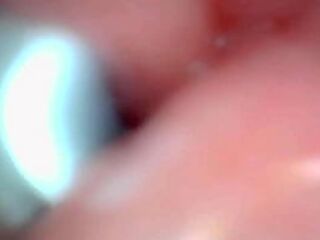 Endoscope camera captures moment of male ejaculation