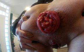Cum on my prolapse and piss on my pussy
