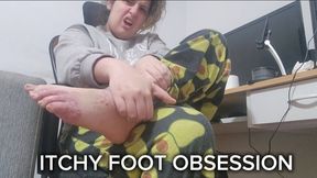 Itchy Foot Obsession – Rubbing, Scratching Between Toes and Cream for Relief